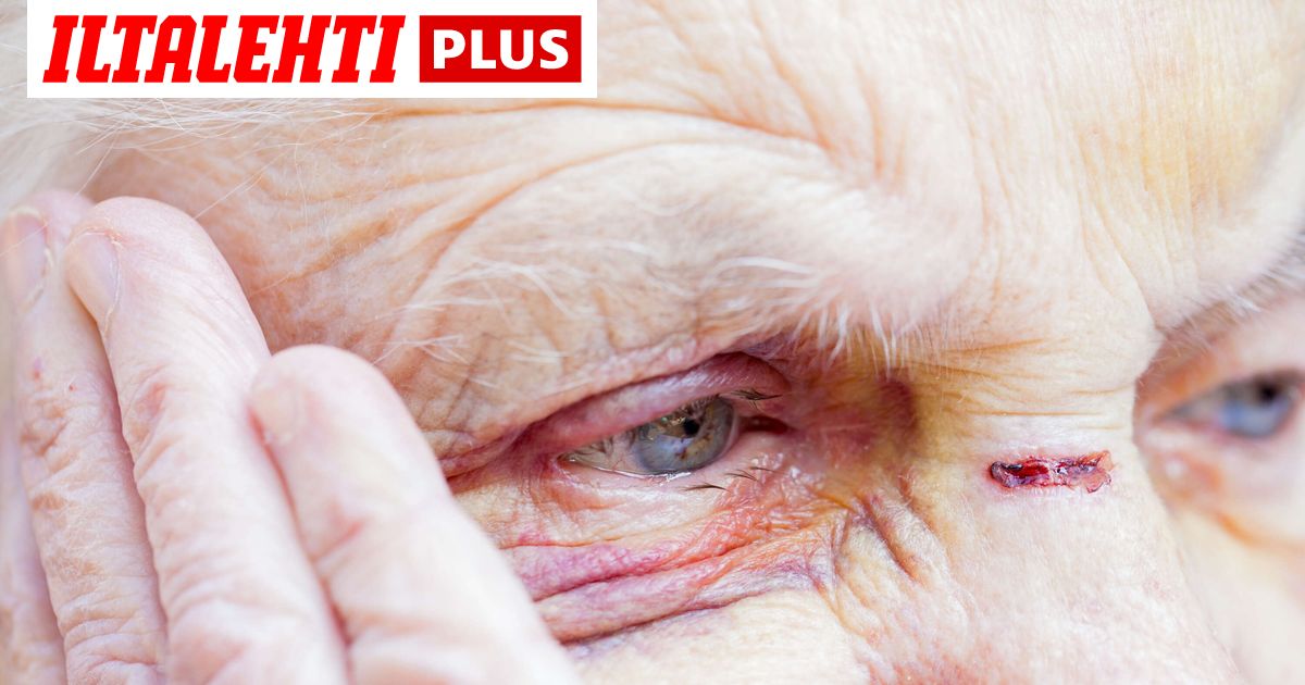 Tappoepäily turkulaisessa hoivakodissa nostaa esiin vakavan kysymyksen vanhusten turvallisuudesta – kuvituskuva